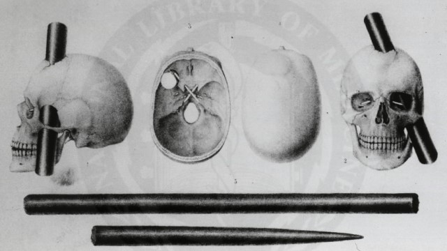 Phineas Gage Donders Wonders