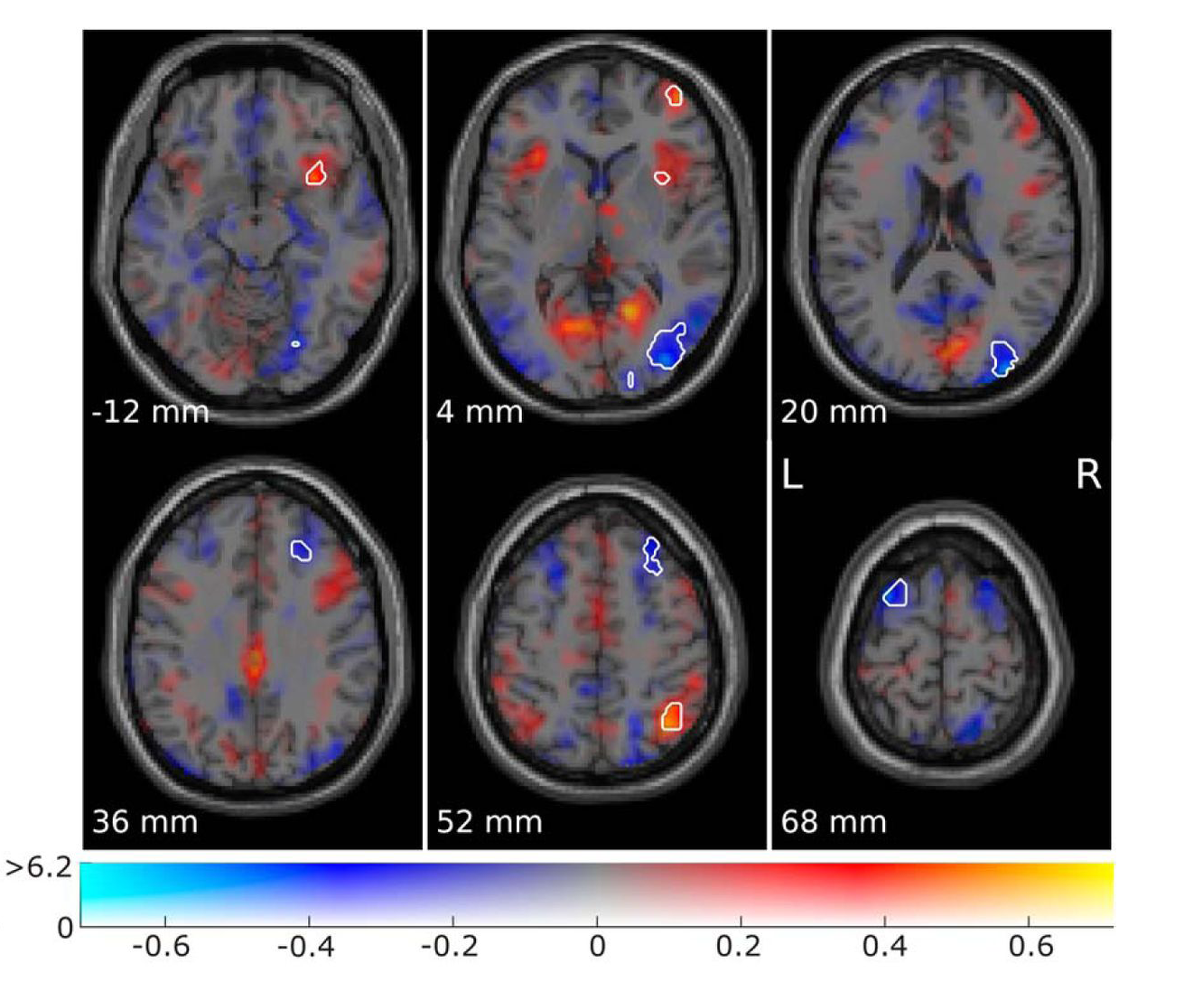 Why so curious? | Donders Wonders