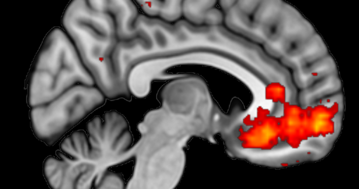 How do we measure brain activity with an MRI scanner?