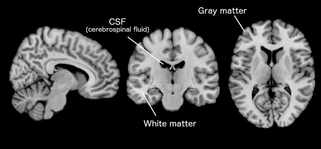 wees onder de indruk kleding breedte MRI als methode om anatomie, communicatie en chemie in het brein te  onderzoeken? | Donders Wonders